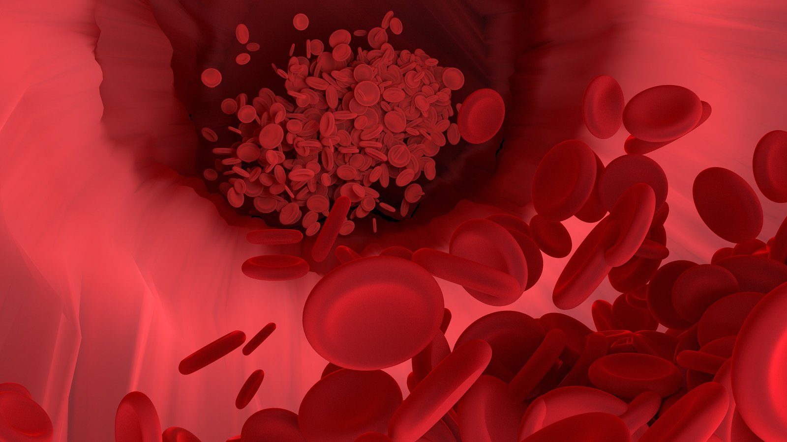 World Thalassemia Day 2022 Doctor Explains Myths And Facts About This 